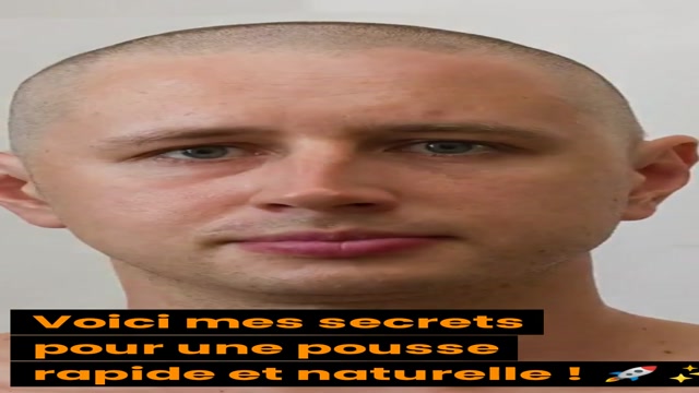 pousse-de-cheveux-naturel